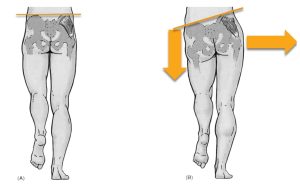 body alignment and knee pain